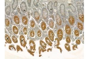 ABIN6257108 and ABIN6275023 at 1/100 staining human normal colon tissue by IHC-P. (COPZ1 Antikörper  (N-Term))