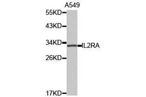 Western Blotting (WB) image for anti-Interleukin 2 Receptor, alpha (IL2RA) antibody (ABIN1873210) (CD25 Antikörper)