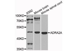 Western blot analysis of extracts of various cells, using ADRA2A antibody. (ADRA2A Antikörper)