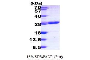 SDS-PAGE (SDS) image for RAB6B, Member RAS Oncogene Family (RAB6B) (AA 1-208) protein (His tag) (ABIN667354)