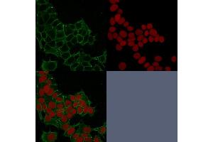 Confocal immunofluorescence image of HeLa cells using Catenin, gamma Mouse Monoclonal Antibody (11E4) Green (CF488) and Reddot is used to label the nuclei Red. (JUP Antikörper)