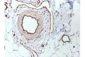 Formalin-fixed, paraffin-embedded human skin stained with CD31 Mouse Monoclonal Antibody (PECAM1/3530). (CD31 Antikörper  (AA 625-738))