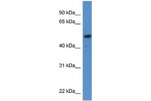 Human HeLa; WB Suggested Anti-SOX5 Antibody Titration: 0. (SOX5 Antikörper  (C-Term))