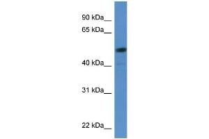 Human HeLa; WB Suggested Anti-SOX5 Antibody Titration: 0.