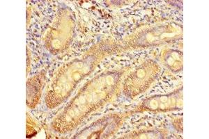 Immunohistochemistry of paraffin-embedded human small intestine tissue using ABIN7173007 at dilution of 1:100 (TMPRSS11D Antikörper  (AA 201-418))