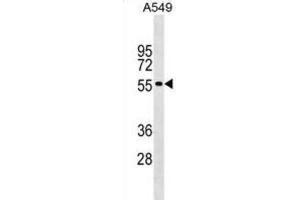 Western Blotting (WB) image for anti-Gliomedin (GLDN) antibody (ABIN2999543) (GLDN Antikörper)