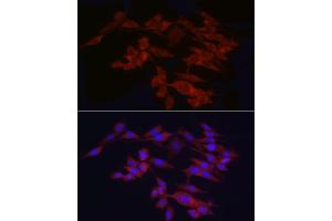 Immunofluorescence analysis of PC-12 cells using WIF1 Rabbit pAb (ABIN6128927, ABIN6150218, ABIN6150220 and ABIN6221033) at dilution of 1:25 (40x lens).