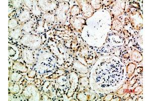 Immunohistochemical analysis of paraffin-embedded human-kidney, antibody was diluted at 1:200 (CD16a, CD16b (AA 100-150) Antikörper)