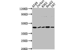 Western Blot Positive WB detected in: A549 whole cell lysate, Jurkat whole cell lysate, K562 whole cell lysate, HepG2 whole cell lysate, U87 whole cell lysate All lanes: DNASE2B antibody at 1:2000 Secondary Goat polyclonal to rabbit IgG at 1/50000 dilution Predicted band size: 42, 18 kDa Observed band size: 42 kDa (DNASE2B Antikörper  (AA 68-281))