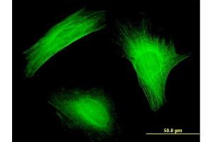 Immunofluorescence (IF) image for anti-Twinfilin, Actin-Binding Protein 1 (TWF1) (AA 80-252) antibody (ABIN562524)