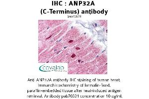 Image no. 1 for anti-Acidic (Leucine-Rich) Nuclear phosphoprotein 32 Family, Member A (ANP32A) antibody (ABIN1731807)