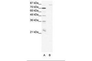Image no. 1 for anti-Mediterranean Fever (MEFV) (N-Term) antibody (ABIN202912)