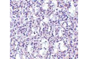 Immunohistochemistry of TBC1D10C in human spleen tissue with TBC1D10C polyclonal antibody  at 2. (Carabin Antikörper  (N-Term))