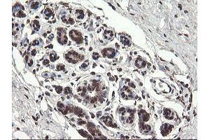 Immunohistochemical staining of paraffin-embedded Human breast tissue using anti-PNPO mouse monoclonal antibody. (PNPO Antikörper)