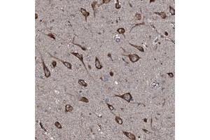 Immunohistochemical staining of human hippocampus with SLC25A38 polyclonal antibody  shows strong cytoplasmic positivity in neuronal cells at 1:50-1:200 dilution.