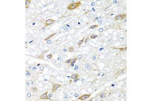Immunohistochemistry of paraffin-embedded rat brain using CPA6 antibody at dilution of 1:100 (40x lens).