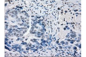 Immunohistochemical staining of paraffin-embedded colon tissue using anti-PRKYmouse monoclonal antibody. (PRKY Antikörper)