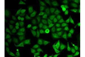 Immunofluorescence analysis of HeLa cells using IMPDH2 antibody (ABIN5973086). (IMPDH2 Antikörper)