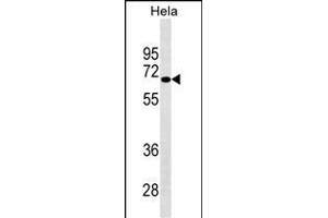 NUAK2 Antibody (ABIN1539841 and ABIN2843822) western blot analysis in Hela cell line lysates (35 μg/lane). (NUAK2 Antikörper)