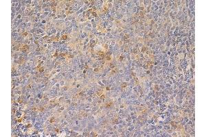 ABIN6261451 and ABIN6266860 at 1/100 staining human normal tonsil tissue by IHC-P.
