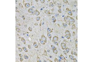 Immunohistochemistry of paraffin-embedded mouse brain using PDIA6 Antibody (ABIN5974243) at dilution of 1/100 (40x lens). (PDIA6 Antikörper)