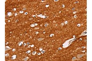The image on the left is immunohistochemistry of paraffin-embedded Human brain tissue using ABIN7129824(IGSF8 Antibody) at dilution 1/15, on the right is treated with fusion protein. (IGSF8 Antikörper)