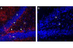 Expression of EAAT2 in rat hippocampus.