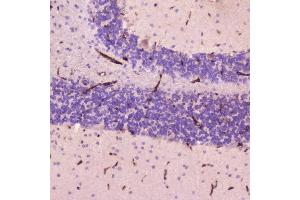 IHC analysis of C Reactive Protein using anti-C Reactive Protein antibody (ABIN5692861).