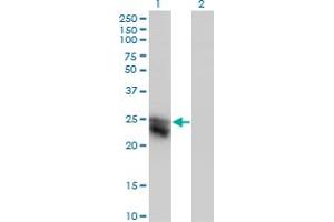 Western Blot analysis of CTHRC1 expression in transfected 293T cell line by CTHRC1 monoclonal antibody (M05), clone 1G12. (CTHRC1 Antikörper  (AA 32-141))