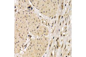 Immunohistochemistry (IHC) image for anti-CD40 (CD40) antibody (ABIN3020704) (CD40 Antikörper)