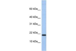 Western Blotting (WB) image for anti-C1D Nuclear Receptor Corepressor (C1D) antibody (ABIN2463344) (C1D Antikörper)