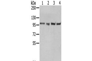 Western Blot analysis of A431, 293T, Hela and K562 cells using TPX2 Polyclonal Antibody at dilution of 1/800 (TPX2 Antikörper)