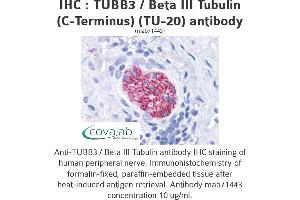 Image no. 1 for anti-Tubulin, beta 3 (TUBB3) (N-Term) antibody (ABIN1724161) (TUBB3 Antikörper  (N-Term))