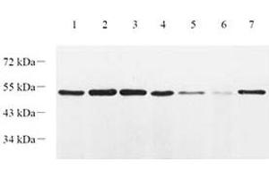 Western blot analysis of EIF2S2 (ABIN7073880) at dilution of 1: 1000,Lane 1: HT29 cell lysate,Lane 2: L1299 cell lysate,Lane 3: CaCO2 cell lysate,Lane 4: Mouse lung tissue lysate,Lane 5: Mouse colon tissue lysate,Lane 6: Mouse small intestine tissue lysate,Lane 7: Rat lung tissue lysate (EIF2S2 Antikörper)