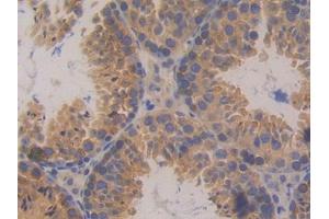 DAB staining on IHC-P; Samples: Mouse Testis Tissue (PKD2 Antikörper  (AA 327-539))