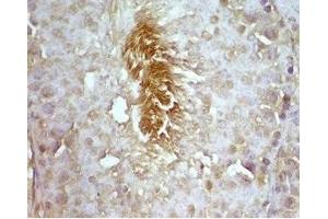 Rat testis tissue was stained by rabbit Anti-Desnutrin (296-318) (Mouse) Serum (PNPLA2 Antikörper  (AA 296-318))