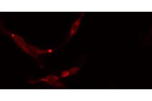 ABIN6273768 staining NIH-3T3 cells by IF/ICC. (MAP2K7 Antikörper  (Internal Region))