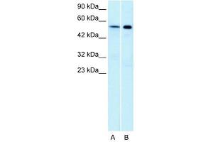 Western Blot showing HTR1A antibody used at a concentration of 1-2 ug/ml to detect its target protein. (Serotonin Receptor 1A Antikörper  (N-Term))
