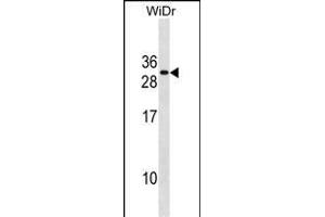 FADD Antibody (Center) (ABIN1881331 and ABIN2838669) western blot analysis in WiDr cell line lysates (35 μg/lane).