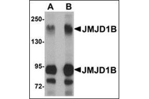 Western blot analysis of JMJD1B in rat liver tissue lysate with this product at (A) 1 and (B) 2 μg/ml.