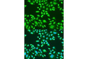Immunofluorescence analysis of U2OS cells using PAX8 antibody (ABIN1874050) at dilution of 1:100. (PAX8 Antikörper)