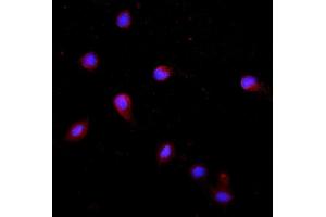 IF analysis of Krt20 using anti-Krt20 antibody (ABIN7601133). (KRT20 Antikörper  (AA 29-431))