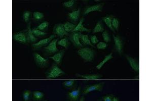Immunofluorescence analysis of U-2 OS cells using REXO2 Polyclonal Antibody at dilution of 1:100 (40x lens). (REXO2 Antikörper)