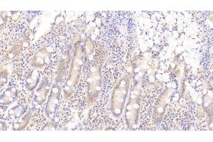 Immunohistochemistry (IHC) image for anti-ADAM Metallopeptidase with thrombospondin Type 1 Motif, 9 (ADAMTS9) (AA 1727-1935) antibody (ABIN7436777)