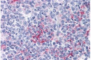Human Tonsil: Formalin-Fixed, Paraffin-Embedded (FFPE) (FCER2 Antikörper)