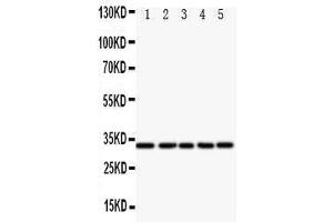 Western Blotting (WB) image for anti-E2F Transcription Factor 6 (E2F6) (AA 162-177), (Middle Region) antibody (ABIN3044189)