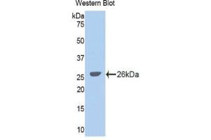 Western blot analysis of the recombinant protein. (GLDC Antikörper  (AA 627-833))