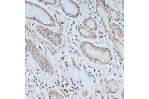 Immunohistochemistry of paraffin-embedded human stomach using TCEB2 antibody (ABIN6131621, ABIN6148934, ABIN6148936 and ABIN6217328) at dilution of 1:100 (40x lens). (TCEB2 Antikörper  (AA 1-118))