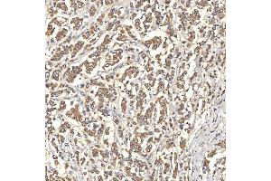 IHC analysis of OAT3/SLC22A8 using anti-OAT3/SLC22A8 antibody (ABIN7599422).
