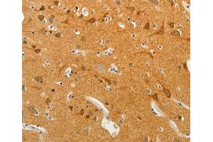 Immunohistochemistry (IHC) image for anti-Solute Carrier Family 18 (Vesicular Monoamine Transporter), Member 2 (SLC18A2) antibody (ABIN3016723) (SLC18A2 Antikörper)